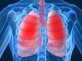Lung Inflammation